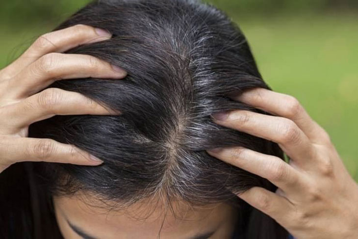 Vì sao tóc bạc? Nguyên nhân khiến tóc bị bạc – Bệnh viện Hồng Ngọc