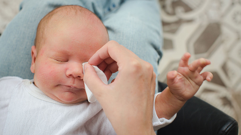 vệ sinh mắt cho trẻ sơ sinh