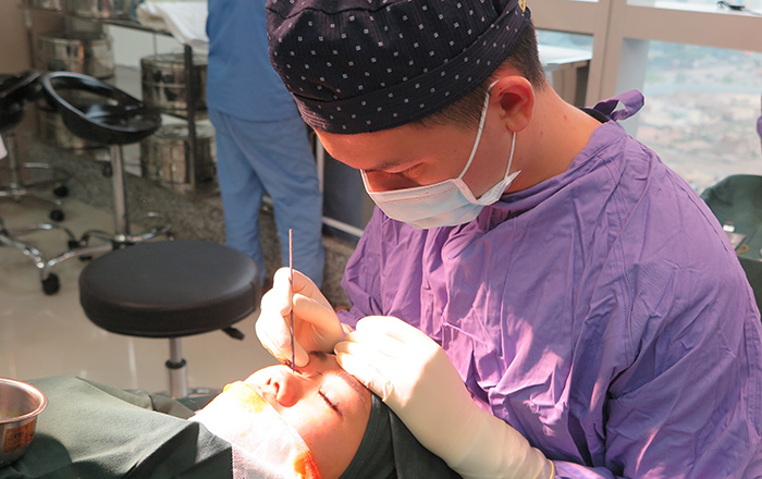 Phẫu thuật nâng mũi bằng silicon đặt trong sống mũi