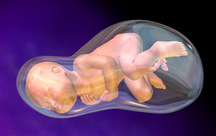 Thiếu ối rất nguy hiểm có thể gây sinh non, thai chết lưu