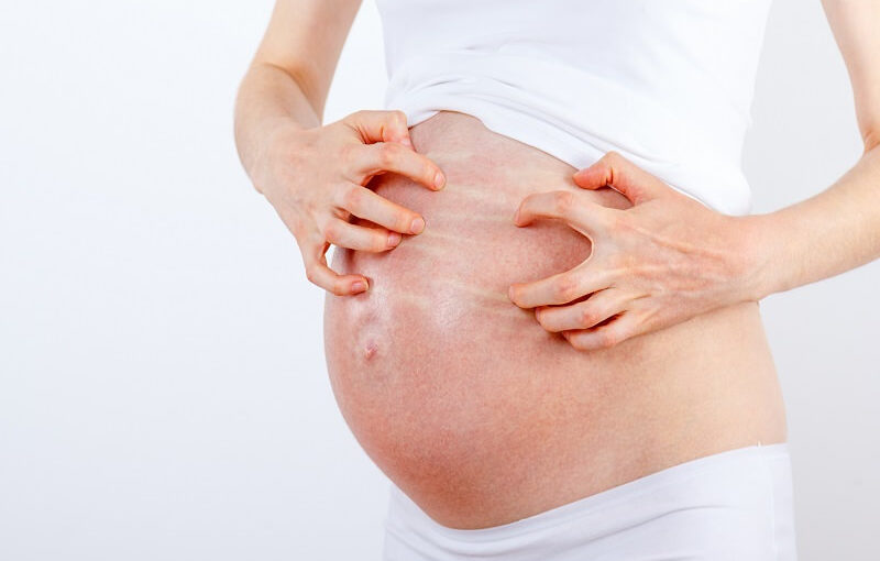 20 bệnh lý thường gặp ở phụ nữ mang thai