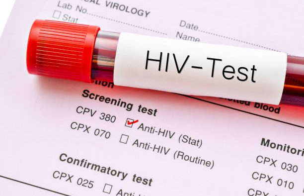 Có bắt buộc phải xét nghiệm HIV khi khám bệnh?