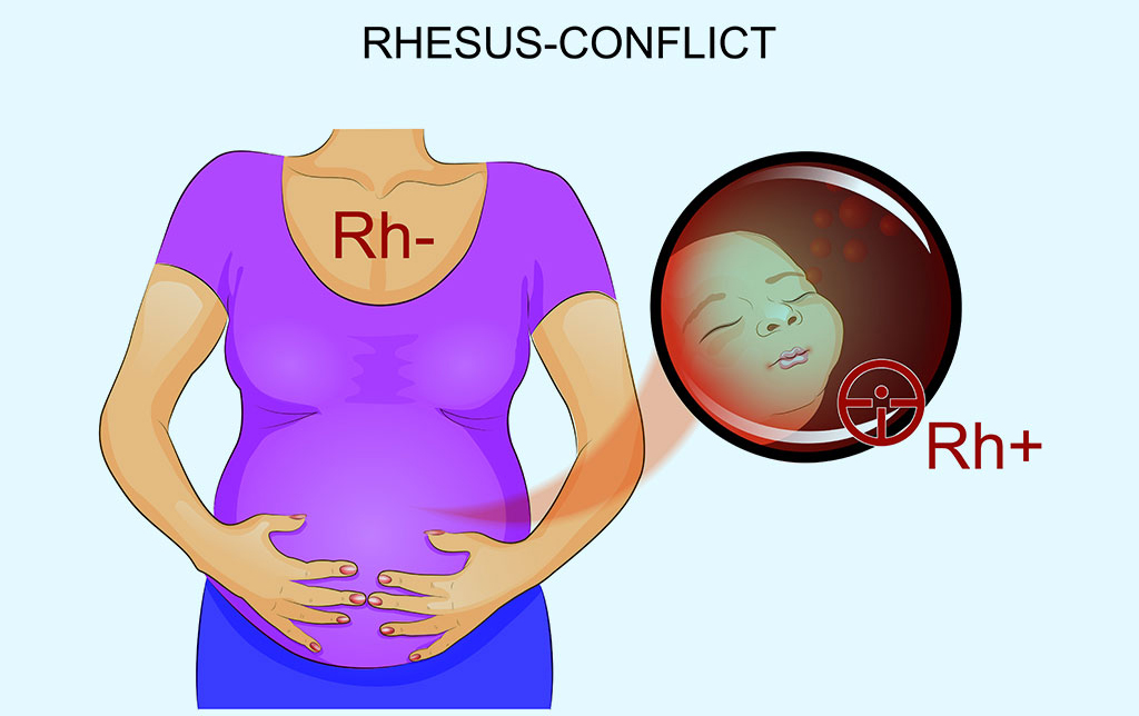 Xét nghiệm yếu tố máu Rh khi mang thai