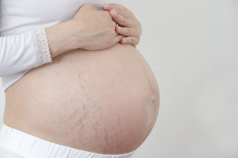 Điểm mặt 9 bệnh ngoài da ở mẹ bầu thường mắc phải