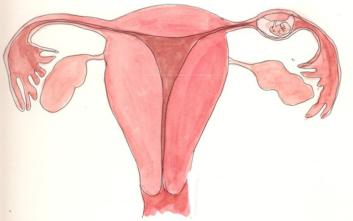 Mang thai ngoài tử cung có dấu hiệu gì