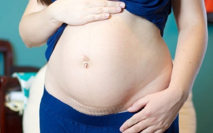 Loại thuốc nào được khuyến khích sử dụng khi đau bụng dưới trong thai kỳ?
