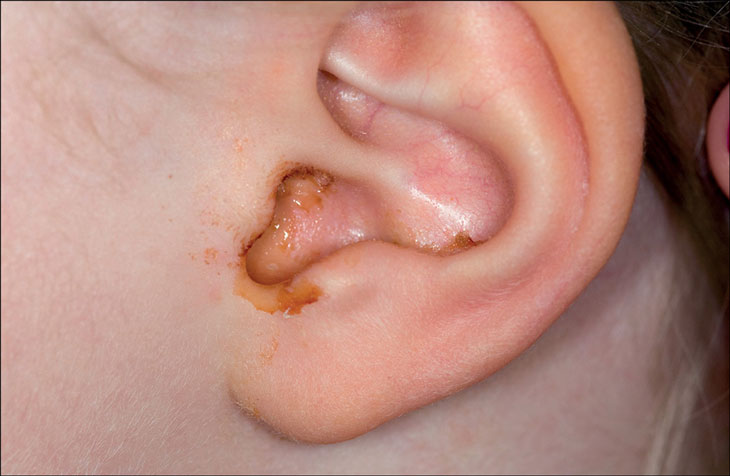 Bệnh tai mũi họng