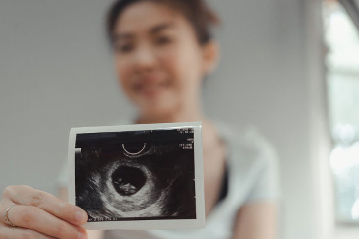 Hút thai 6 tuần tuổi cần chú ý những gì?