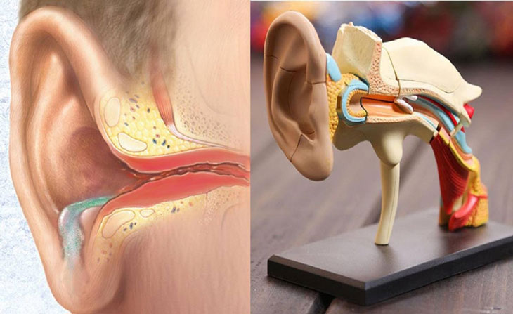 nguyên nhân viêm tai giữa