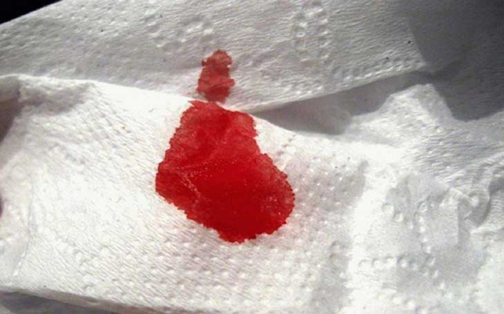 Ra huyết khi mang thai