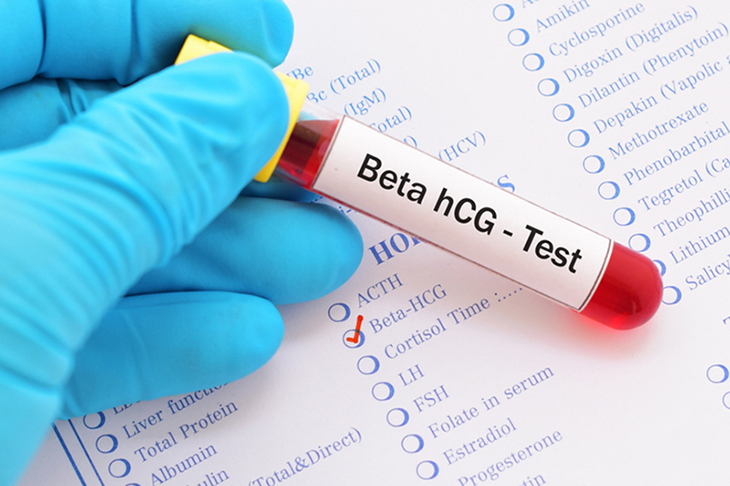 Kiêng gì trước khi xét nghiệm beta HCG