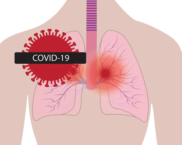 Hậu COVID-19 phổi yếu, dễ mắc xơ phổi