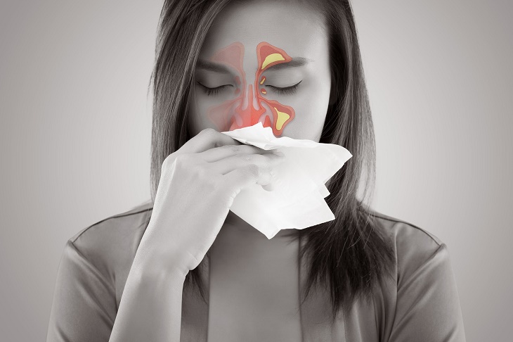 Các phương pháp điều trị viêm xoang mũi 
