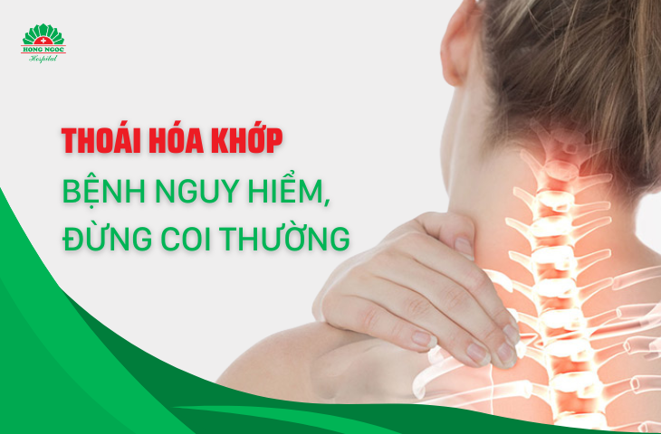 Các loại thuốc điều trị bệnh xương khớp? 
