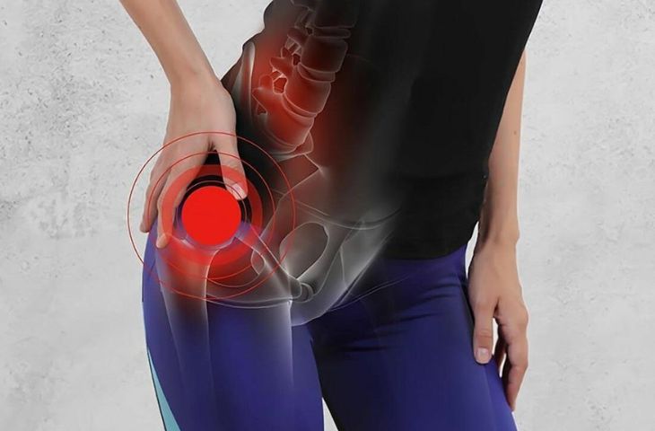 thoái hóa khớp háng