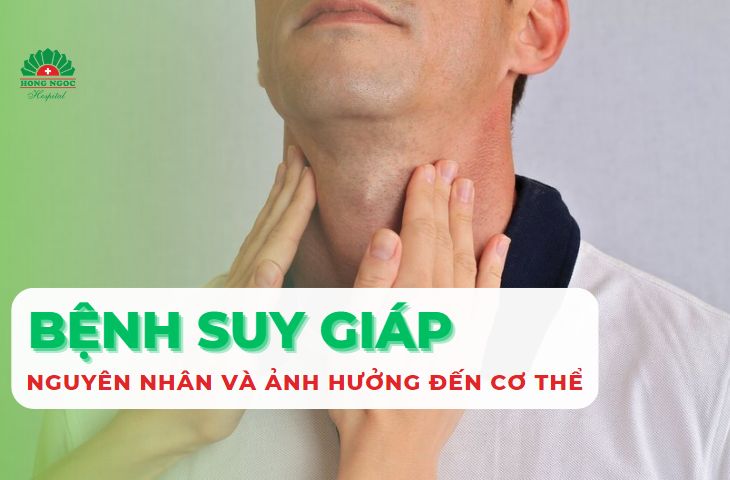 nguyen nhan benh suy giap
