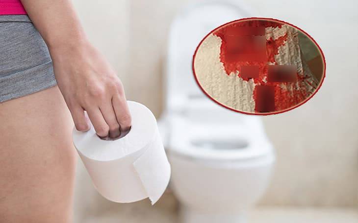 Constipation with blood is dangerous?