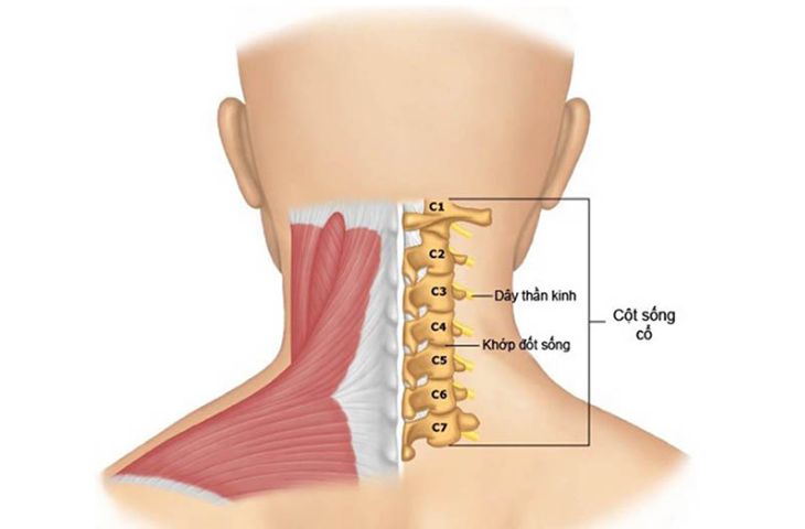 Thoái hóa cột sống cổ: Nguyên nhân, triệu chứng, phòng ngừa và điều trị