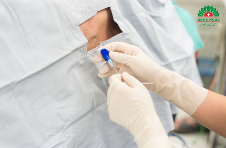 Đẻ không đau bằng phương pháp gây tê ngoài màng cứng