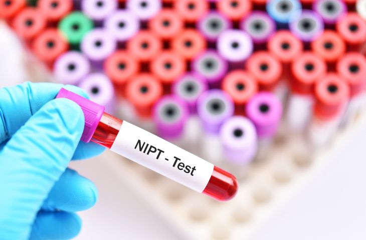 Xét nghiệm NIPT
