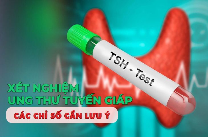 Chỉ số T3 và T4 như thế nào liên quan đến ung thư tuyến giáp?
