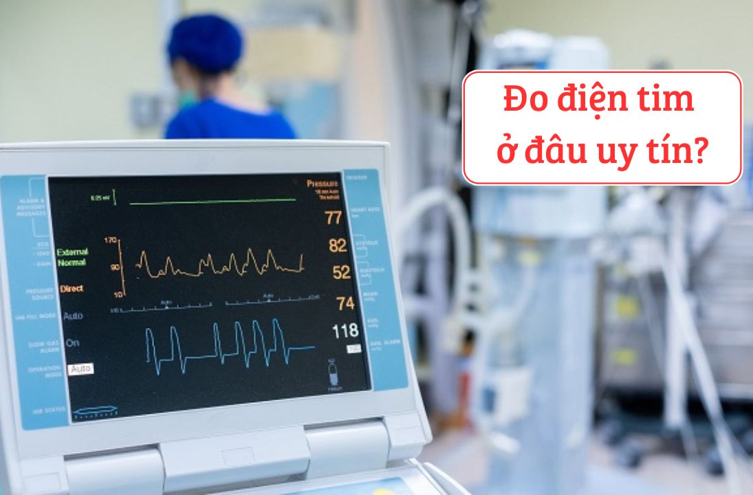 Các lưu ý quan trọng khi áp dụng kỹ thuật đo điện tim trong thực tế?