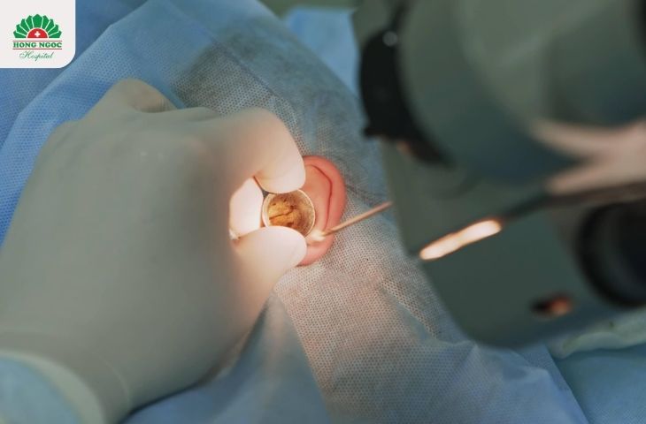 Phẫu thuật điều trị viêm ống tai ngoài