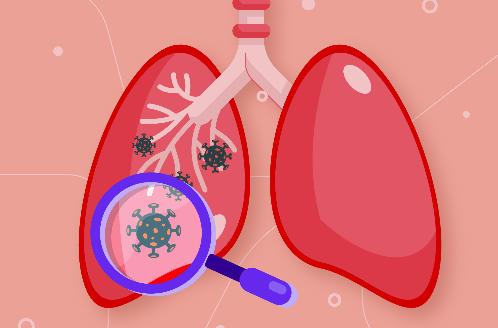  khi nào cần nội soi phế quản