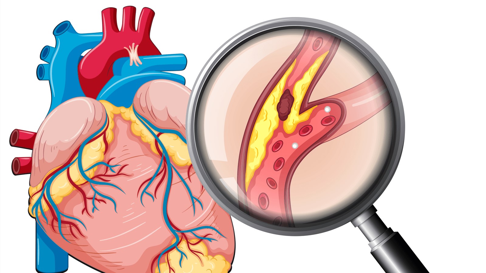 Đối tượng mắc các bệnh tim bẩm sinh thường có nguy cơ mắc block nhĩ thất cao