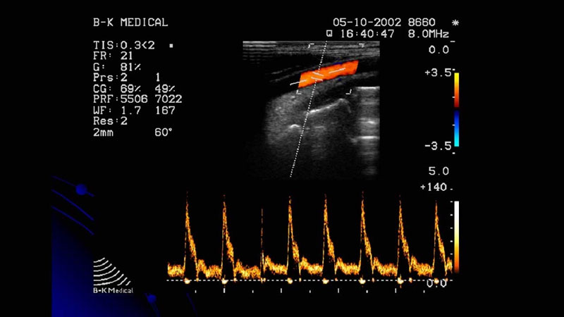 Siêu âm Doppler là kỹ thuật quan trọng trong chẩn đoán các vấn đề về tim