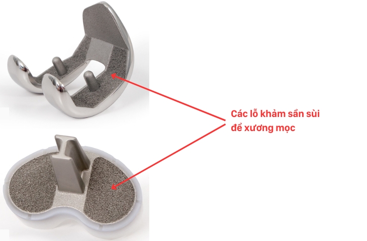 các loại khớp gối nhân tạo