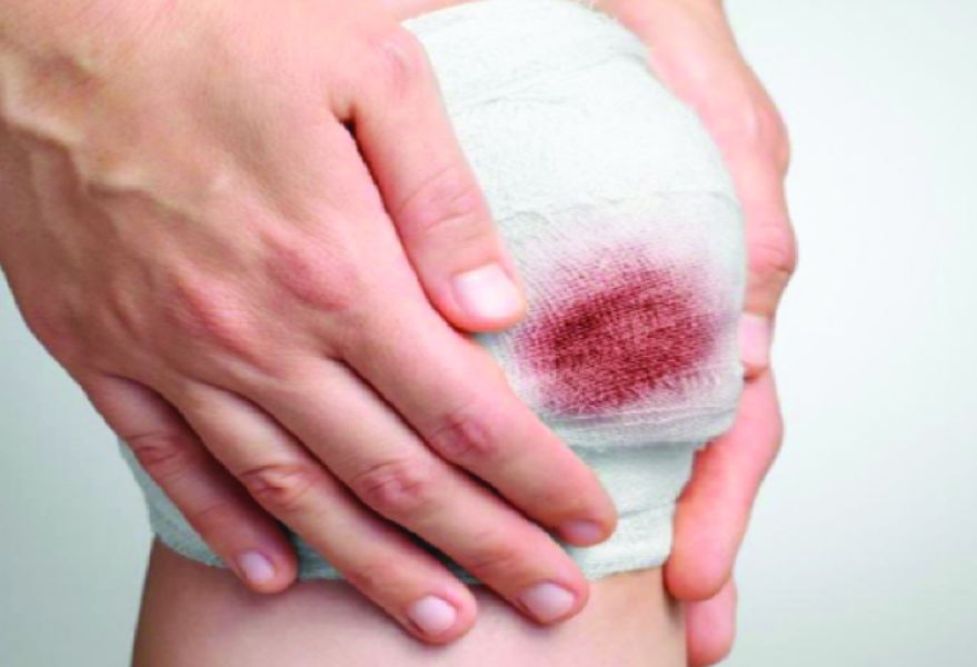 viêm khớp nhiễm khuẩn