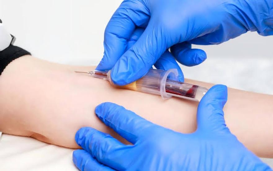 Xét nghiệm máu là phương pháp chính để chẩn đoán bệnh Cholesterol cao